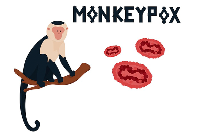 5 Key Facts about Monkeypox & Monkeypox Test to Keep You Safe
