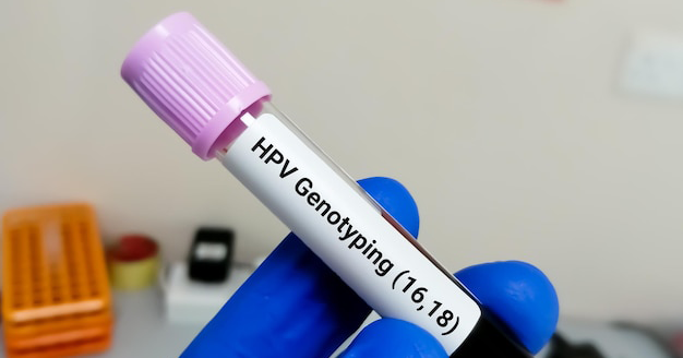 Why Must We Pay More Attention to HPV Type 16 and 18?