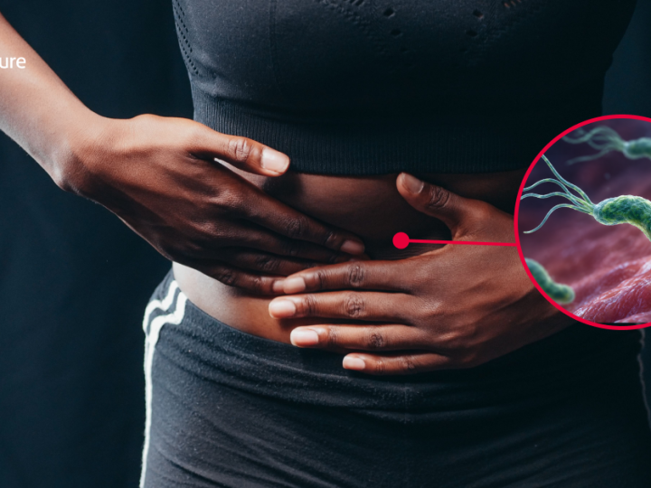 1 in 2 May Be Infected. So How Do You Know If You Have H. pylori?