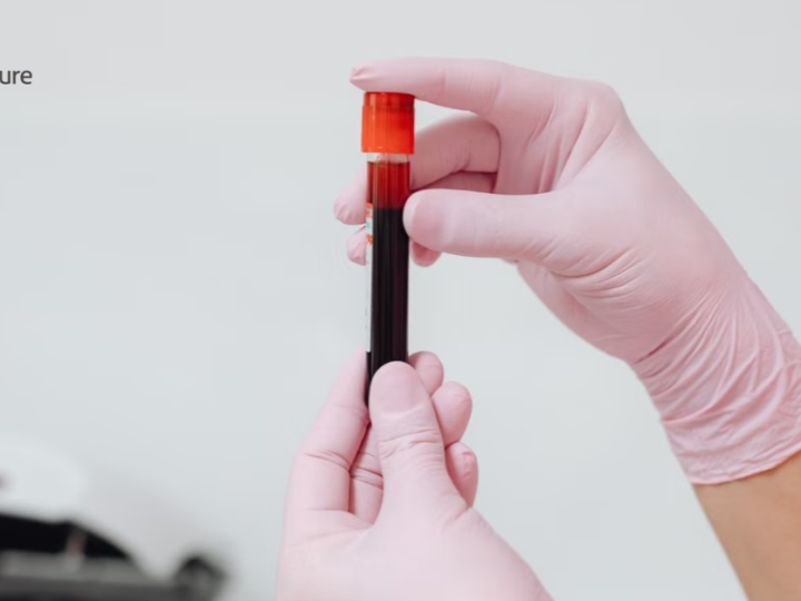 Precision Screening, Safer Transfusions: How NAT Is Reshaping Blood Safety?